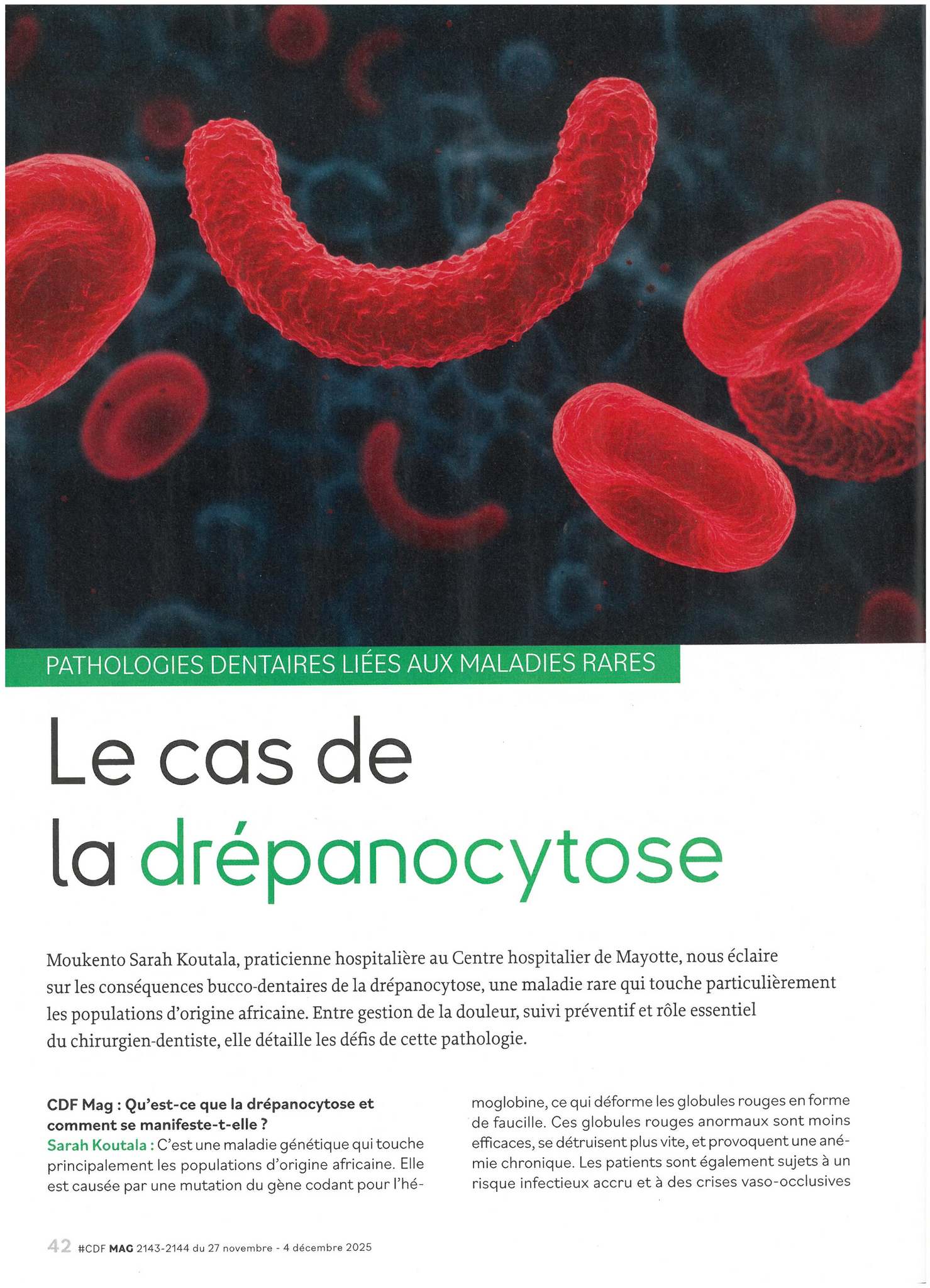 drepano