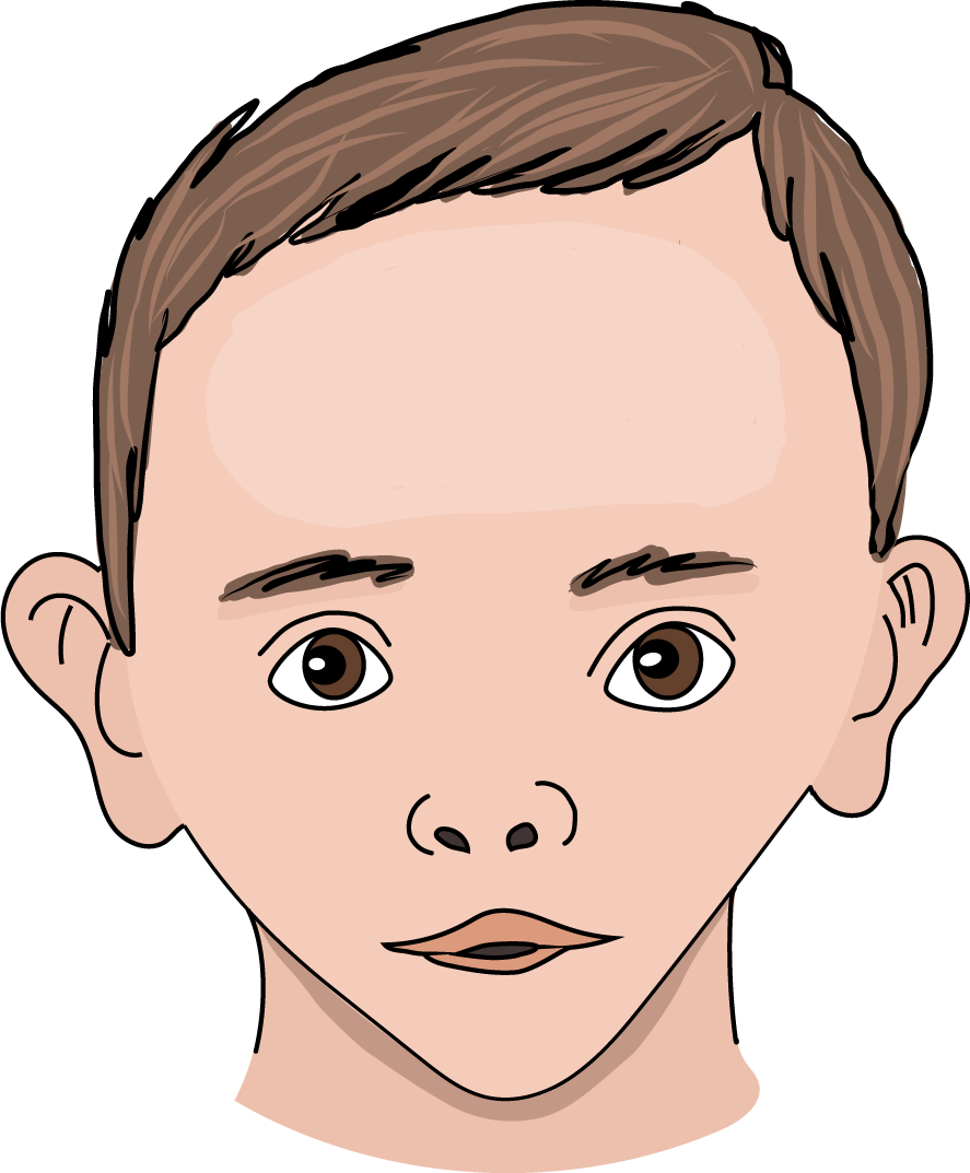 Image Syndrome Silver Russell