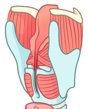 Zoom 22 diastème type II